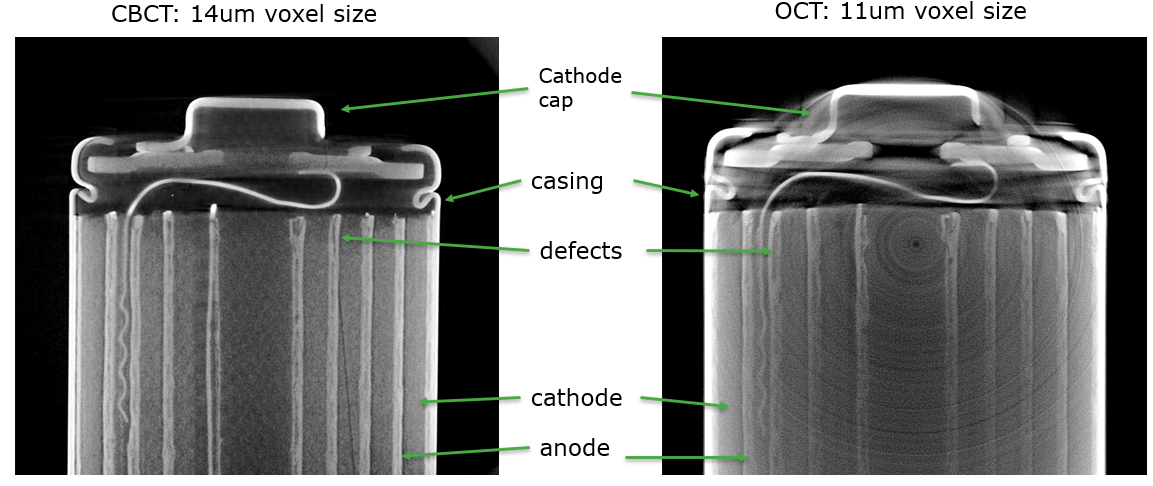 X-ray battery inspection